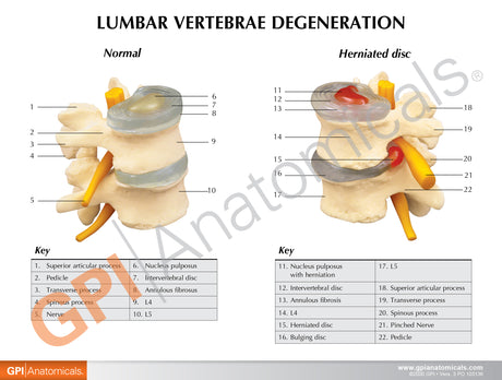 4-Stage Vertebrae Education Card