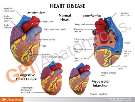 3-Piece Mini Heart Model Set