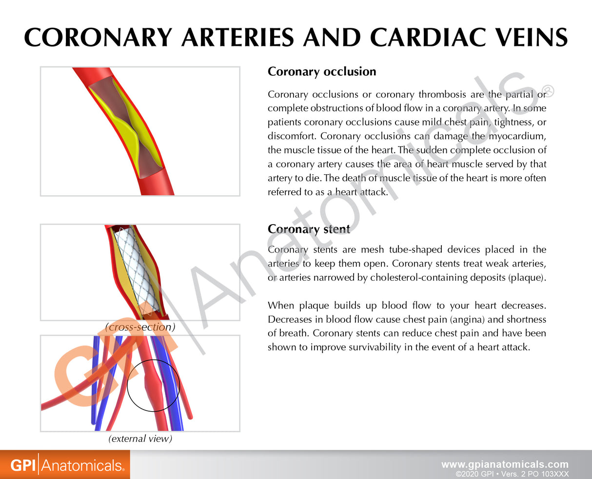 Coronary Arteries and Cardiac Veins Education Card