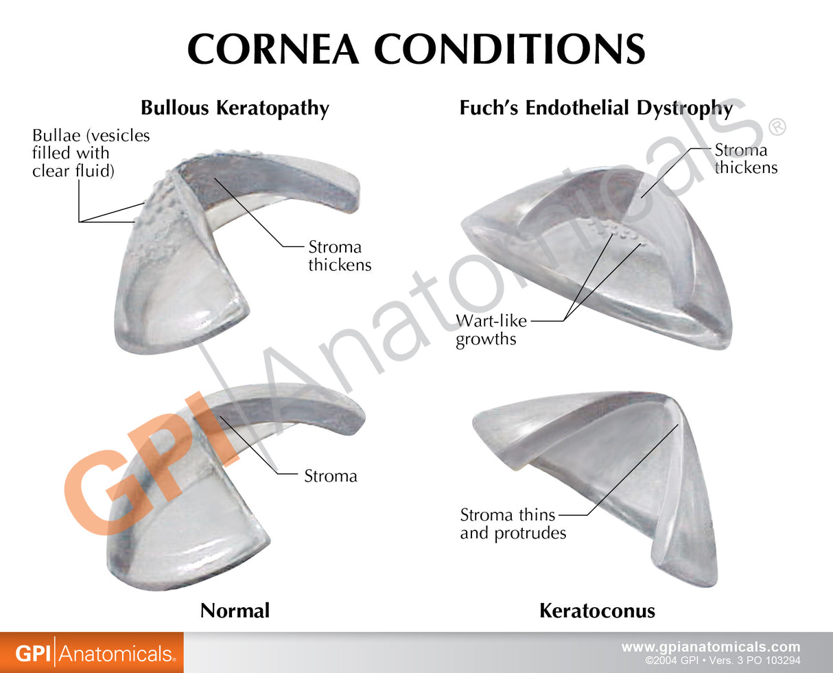 Cornea Eye Education Card