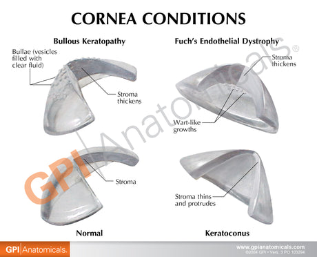 Cornea Eye Education Card