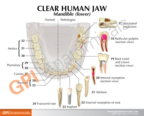 Clear Teeth Education Card