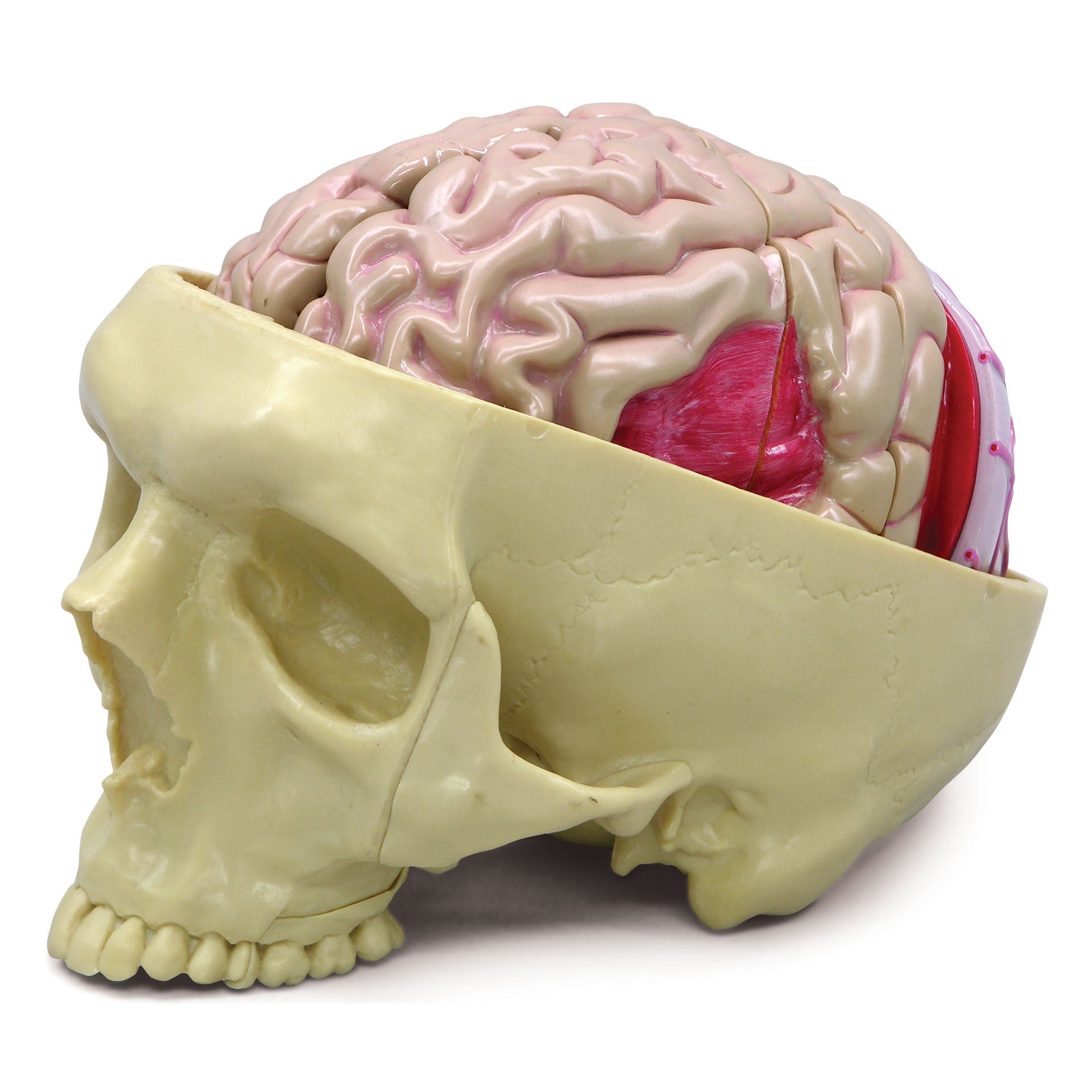 Brain with Partial Skull Model – GPI 3D Anatomy