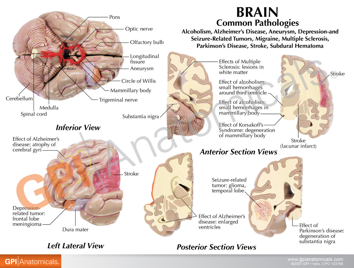 Brain with Partial Skull Education Card