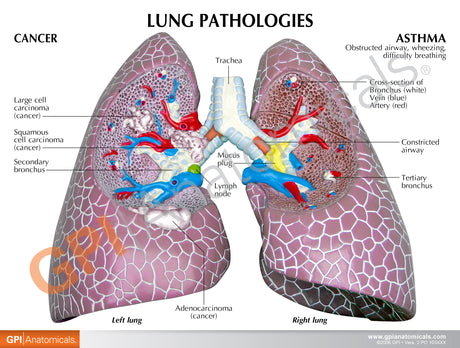 Lung Model Set with Pathologies