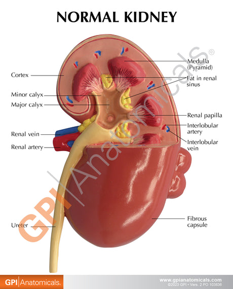 Normal and Diseased Kidney Model