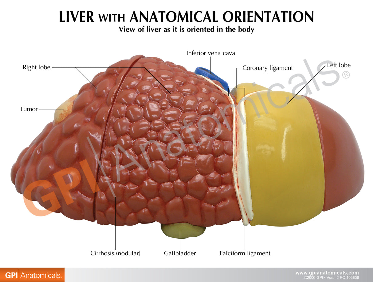 Liver Model with Common Pathologies