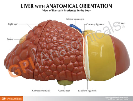 Liver Model with Common Pathologies