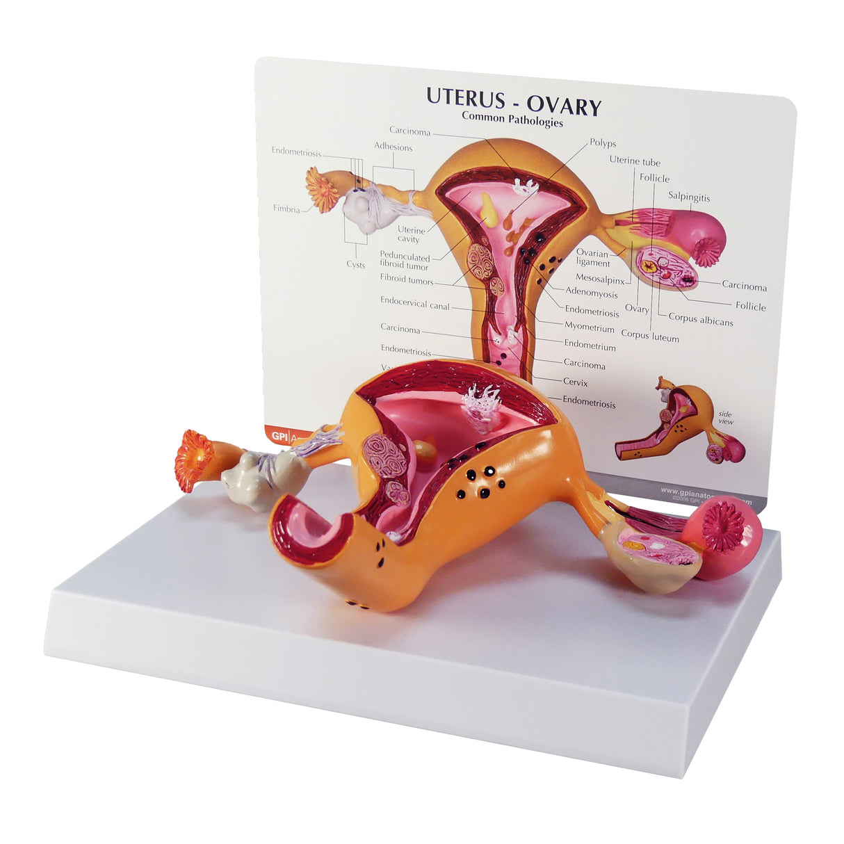 Uterus and Ovary Model