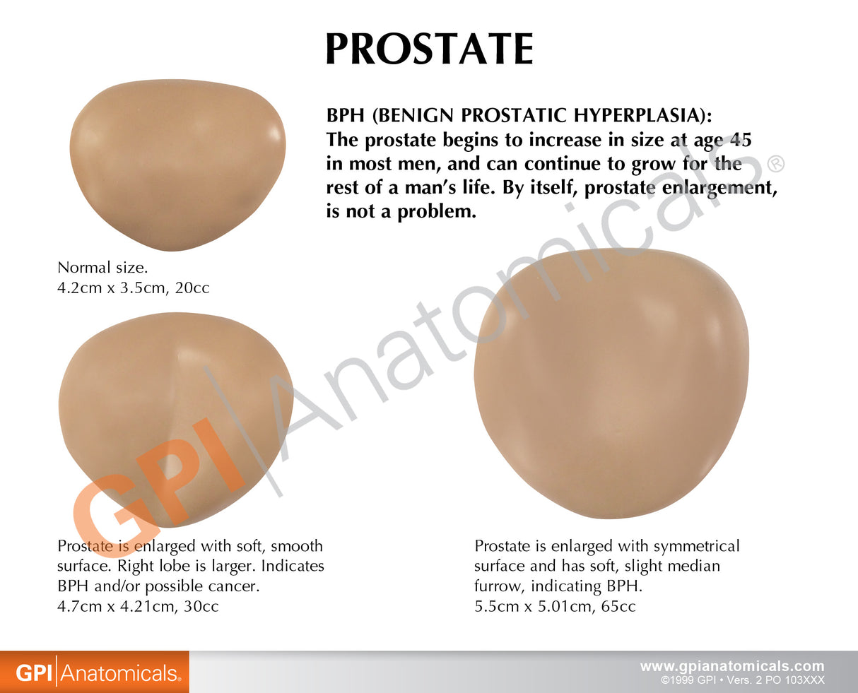 Male Pelvis with Prostate Education Card