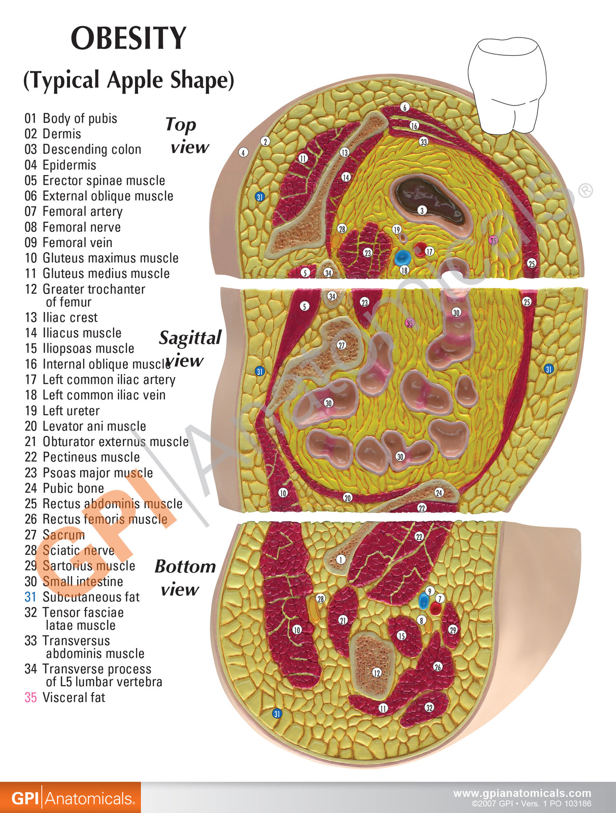 Obesity Model