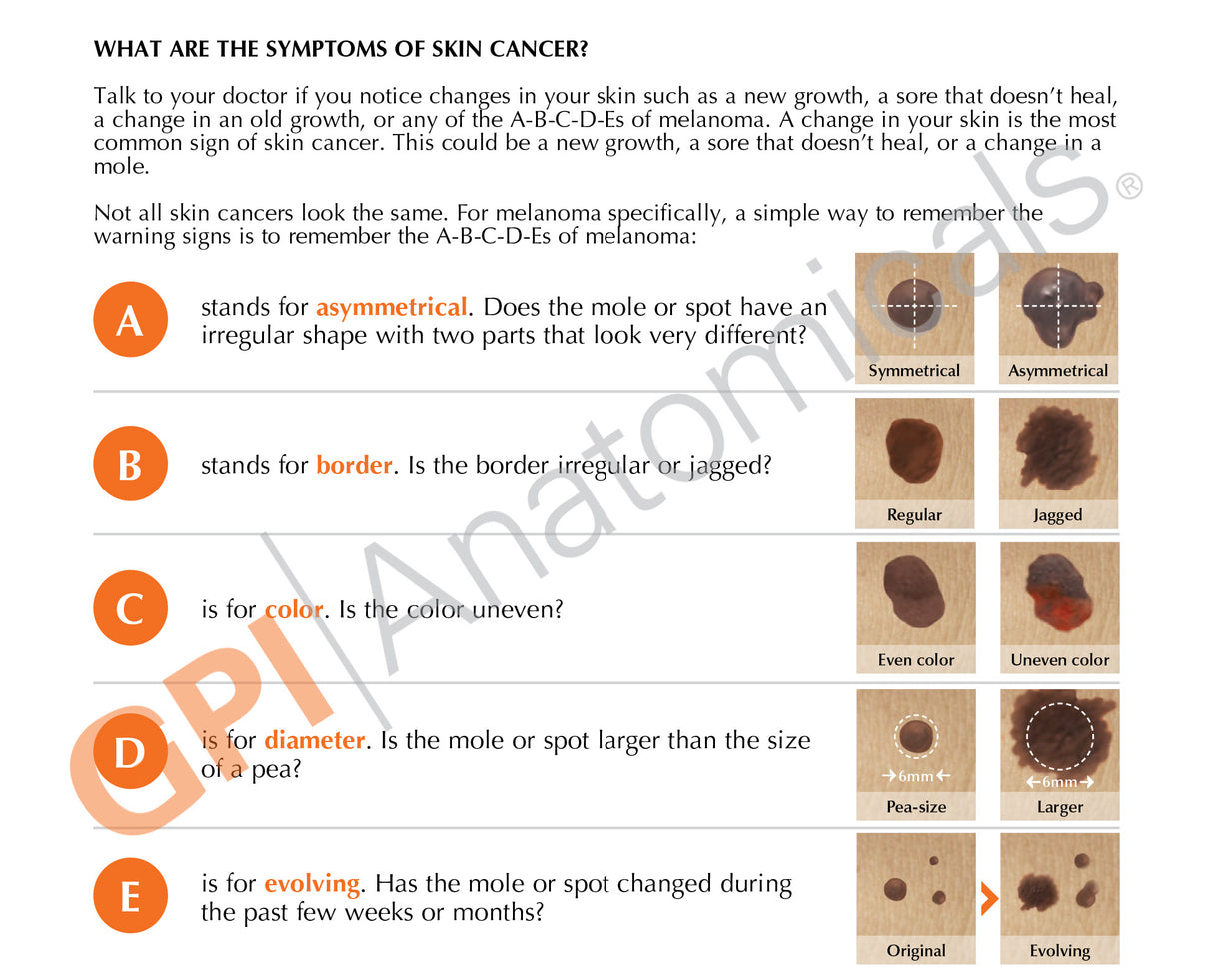 Melanoma Skin Cancer Education Card