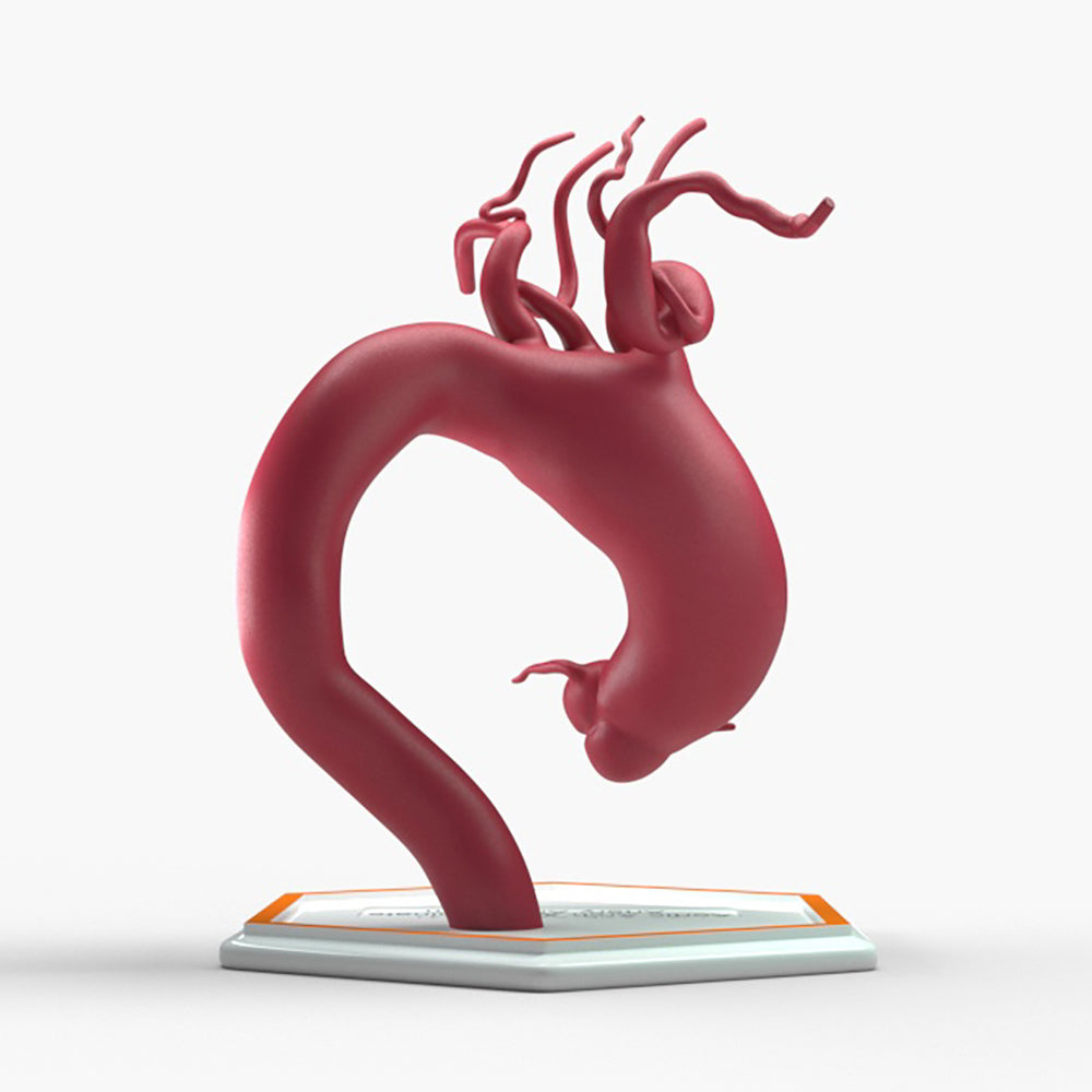 Ascending Supracoronary Aortic Arch and Innominate Artery Aneurysm
