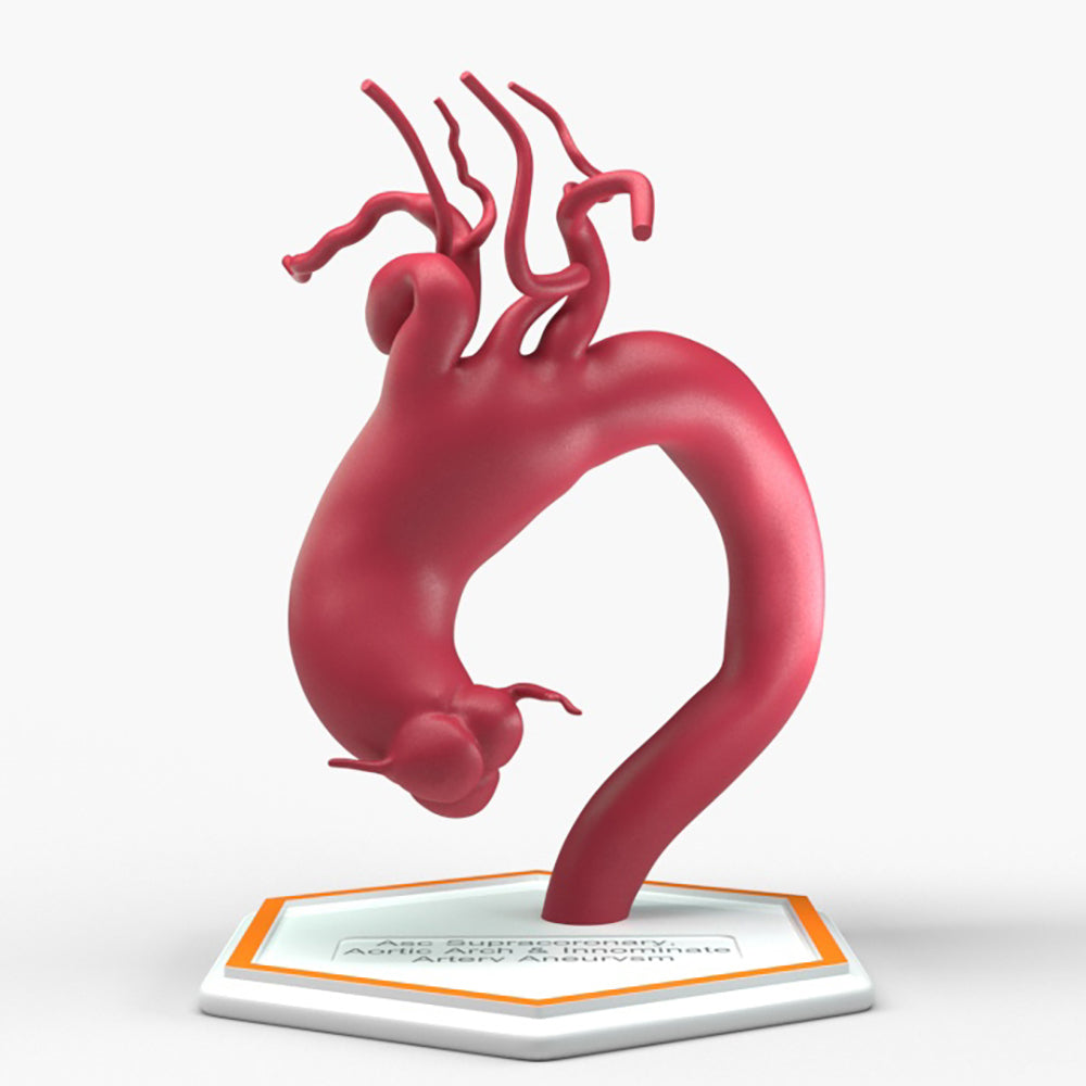 Ascending Supracoronary Aortic Arch and Innominate Artery Aneurysm