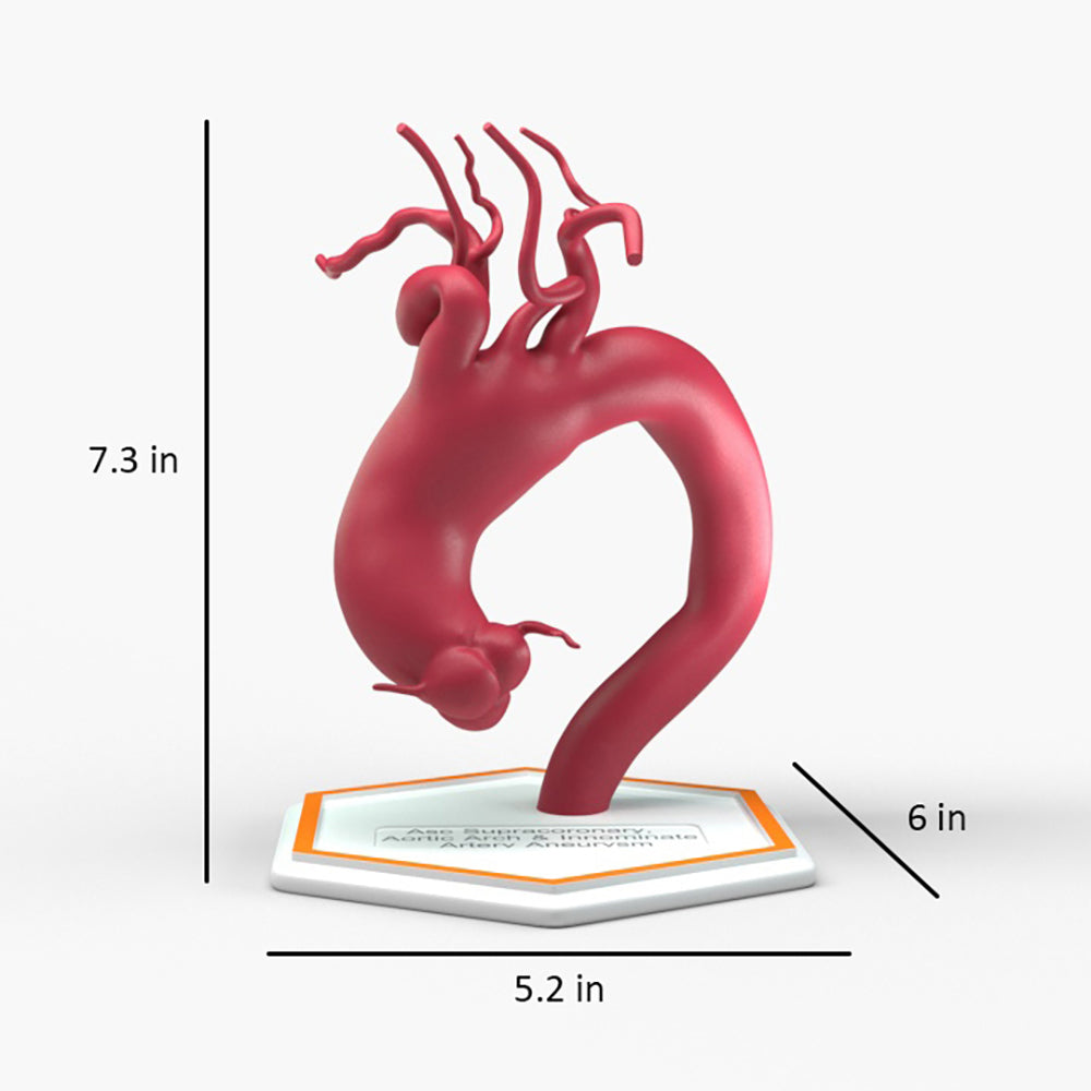 Ascending Supracoronary Aortic Arch and Innominate Artery Aneurysm