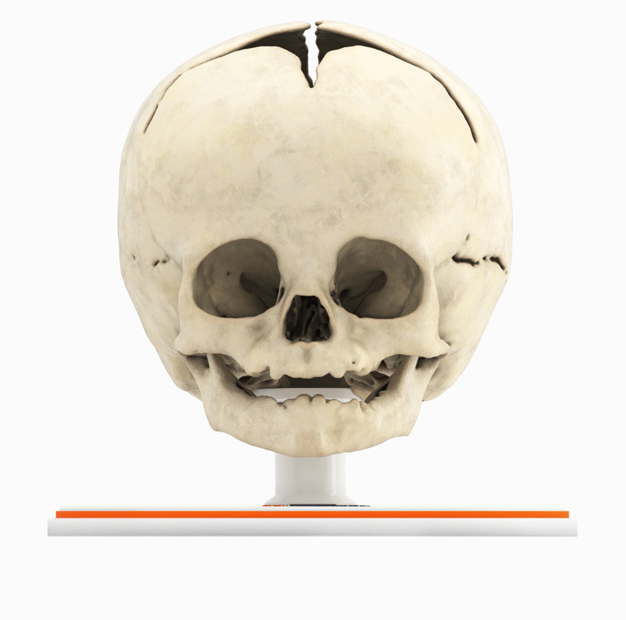 Custom 3D Anatomy Models | Infant Skull | 8 Month Old Male – GPI