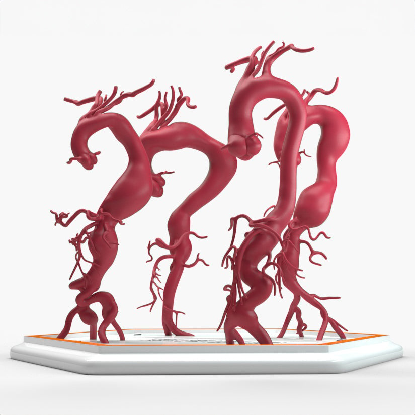 Thoracoabdominal Aortic Aneurysms 1-4