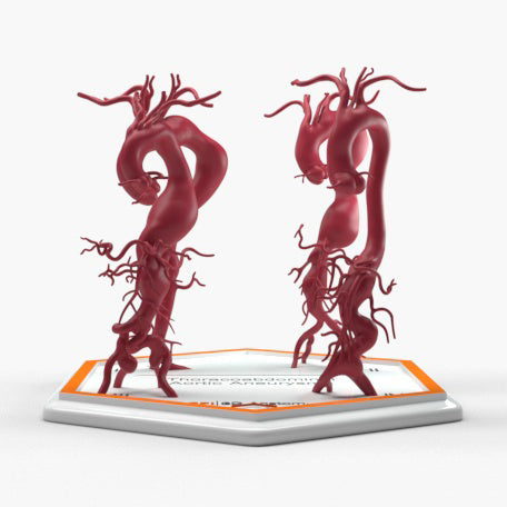 Thoracoabdominal Aortic Aneurysms 1-4