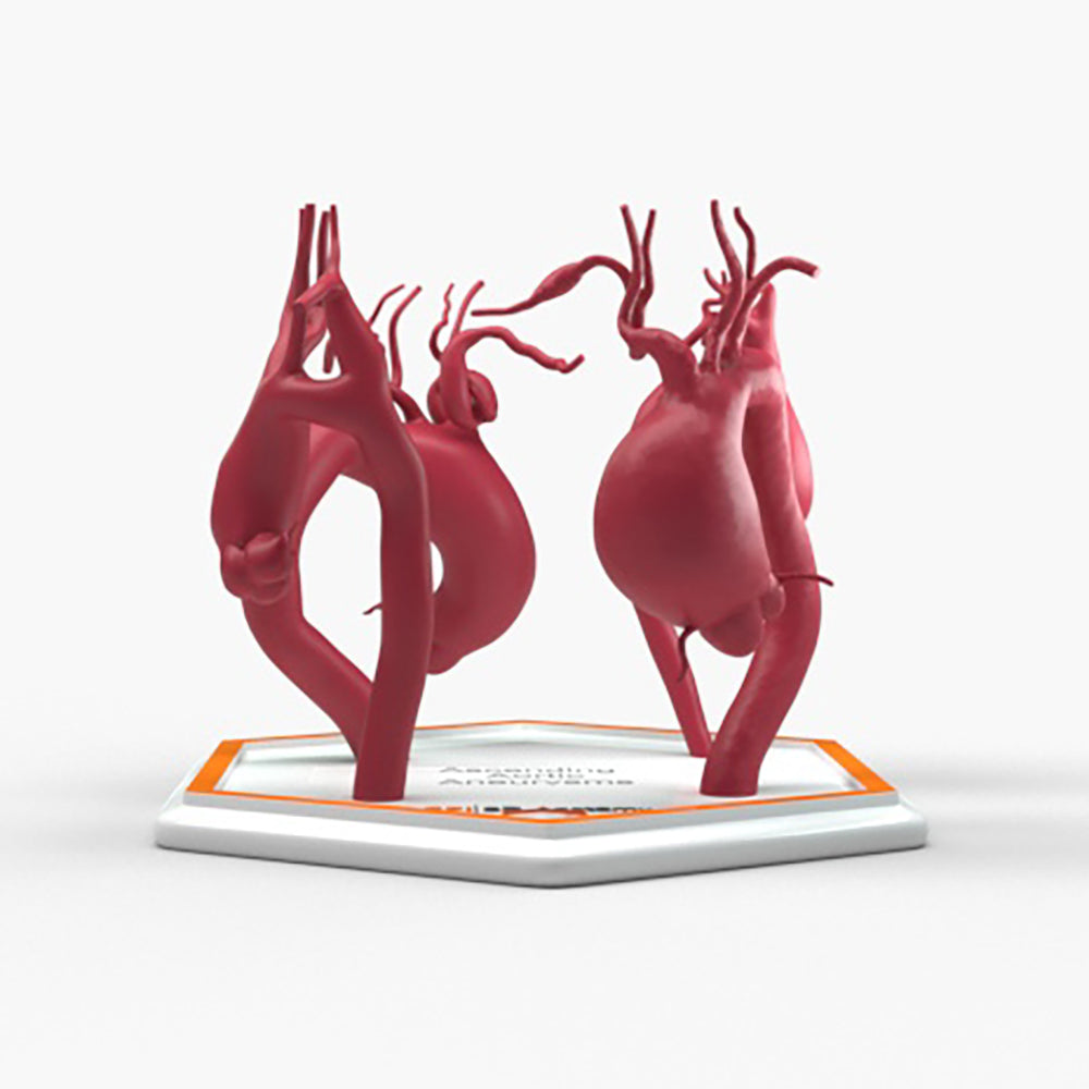 Ascending Aortic Aneurysms 1