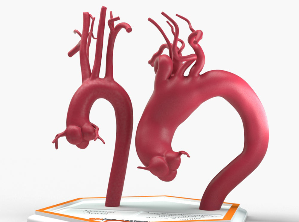 Ascending Supracoronary Aortic Arch and Innominate Artery Aneurysm and Normal