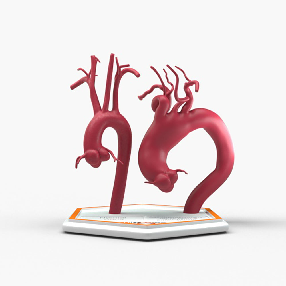 Ascending Supracoronary Aortic Arch and Innominate Artery Aneurysm and Normal