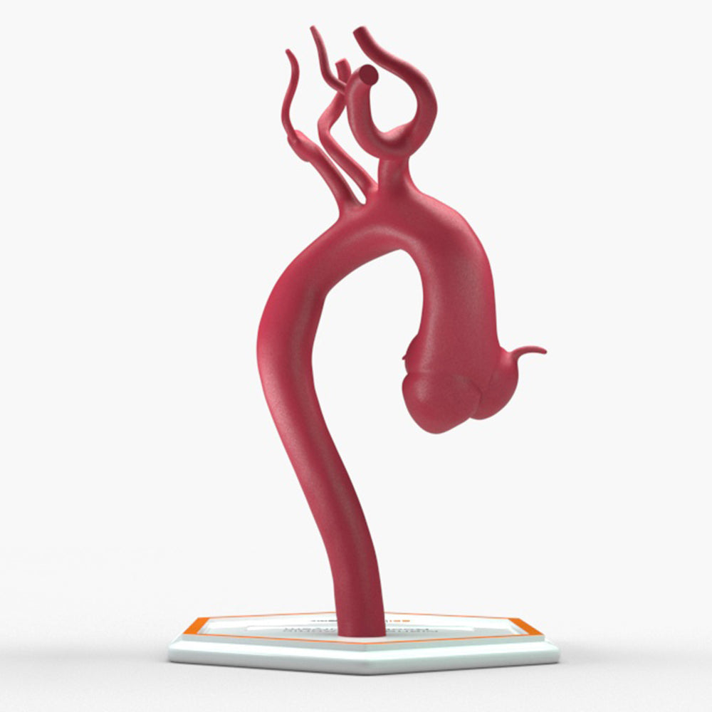 Marfanoid Aortic Root Aneurysm