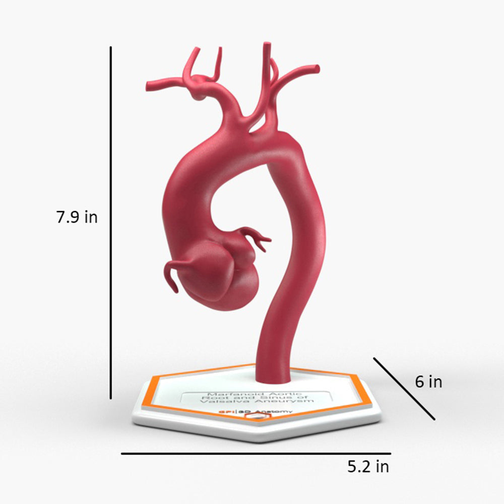 Marfanoid Aortic Root and Sinus of Valsalva Aneurysm
