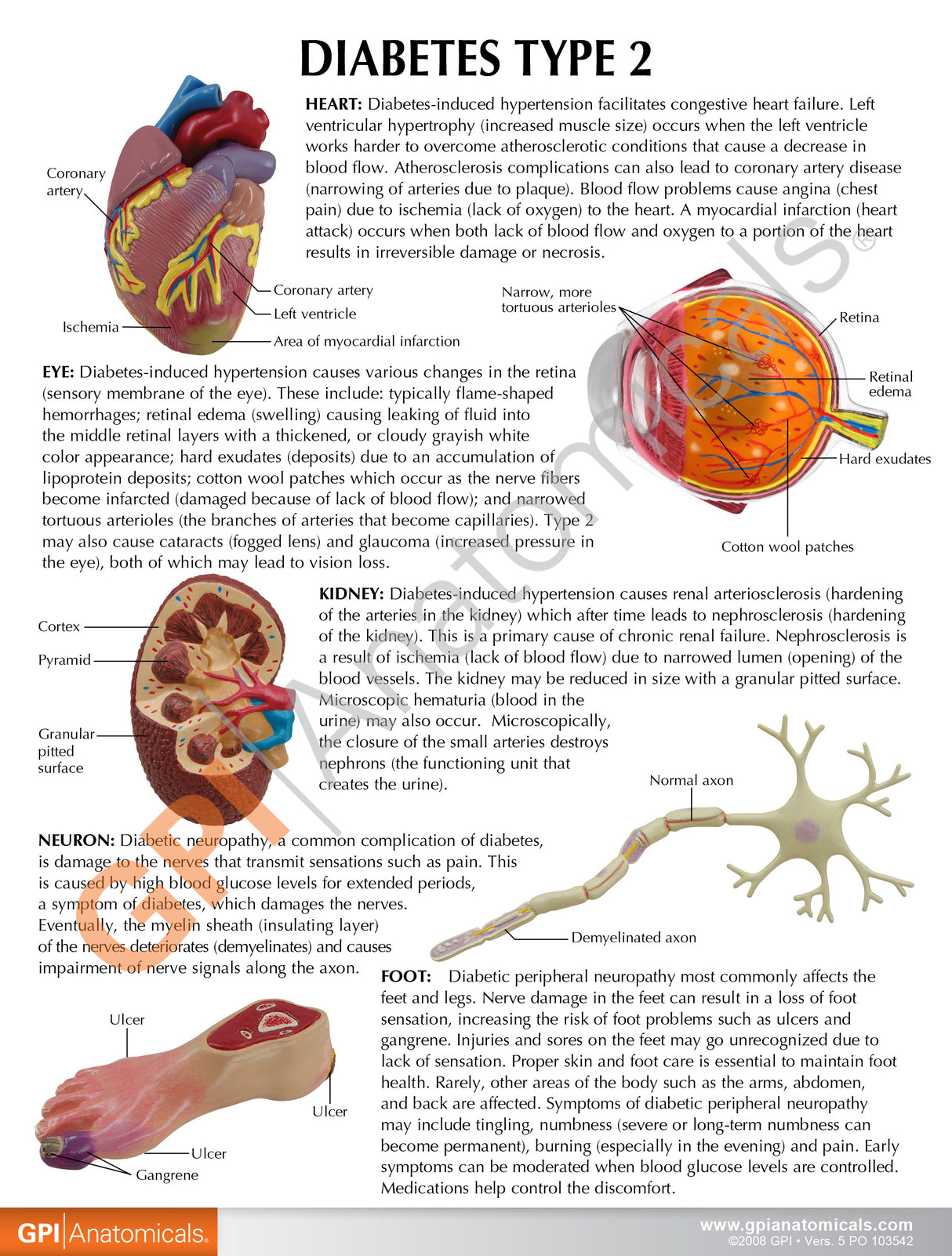 Type II Diabetes Model Set