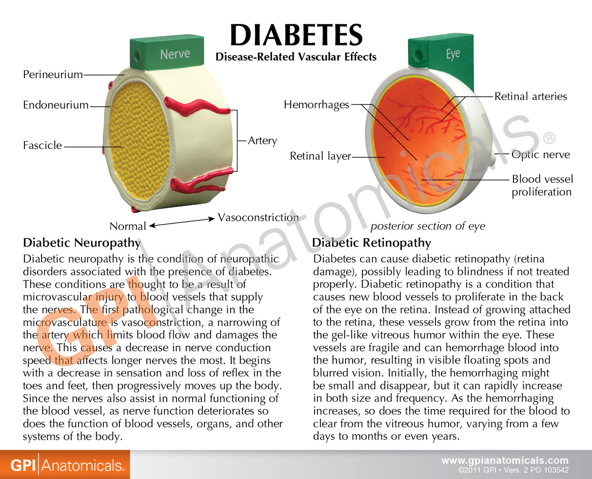 4-Piece Diabetes Education Card