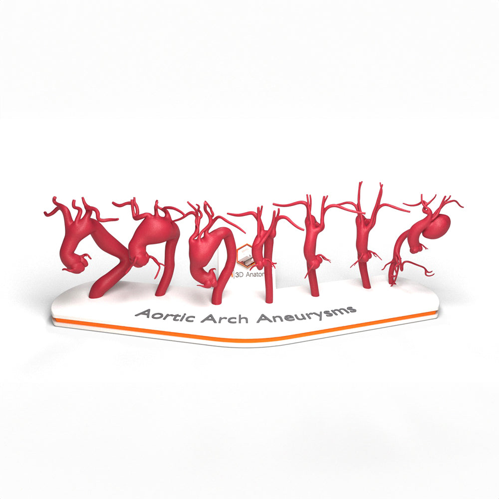 Aortic Arch Aneurysm Set