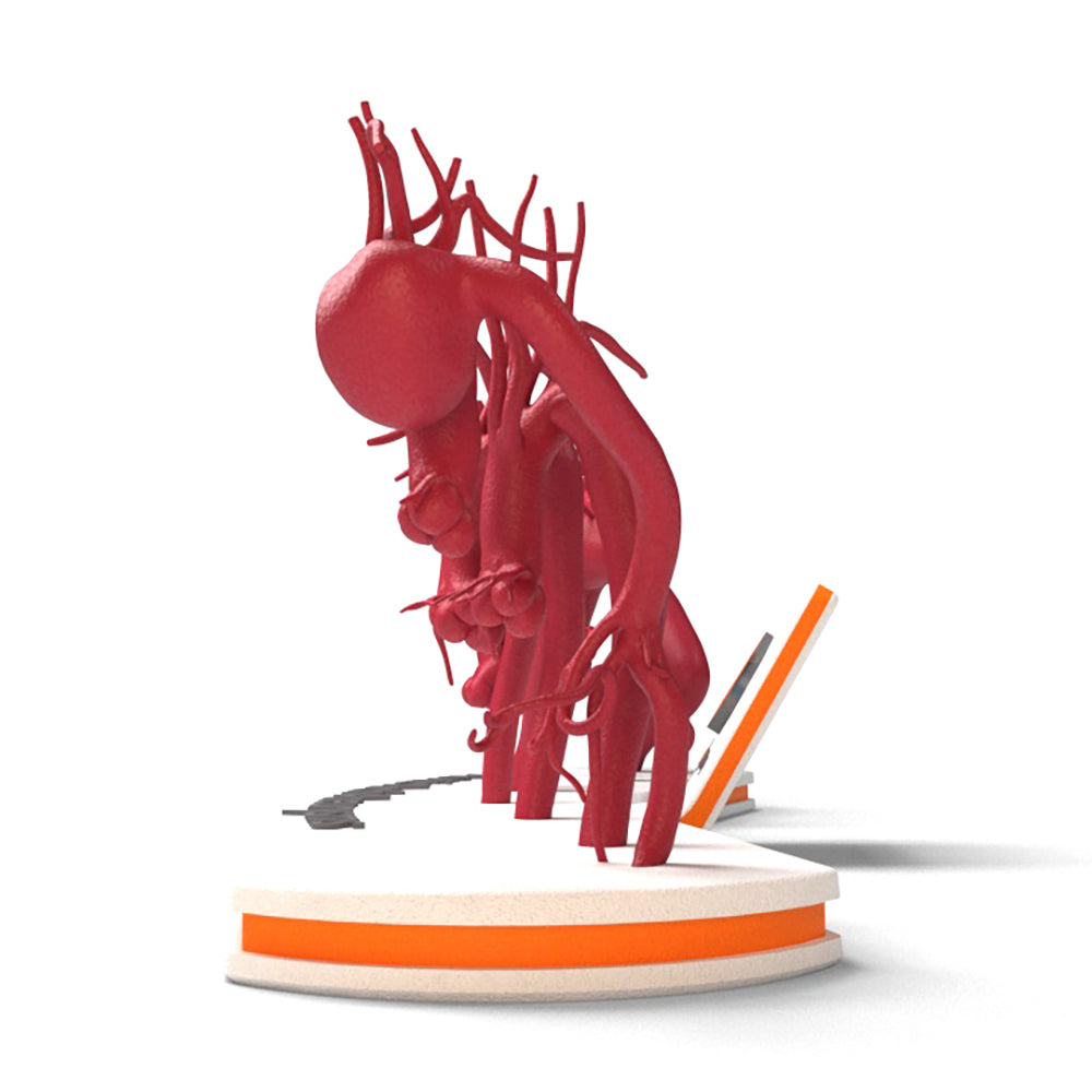 Aortic Arch Aneurysm Set