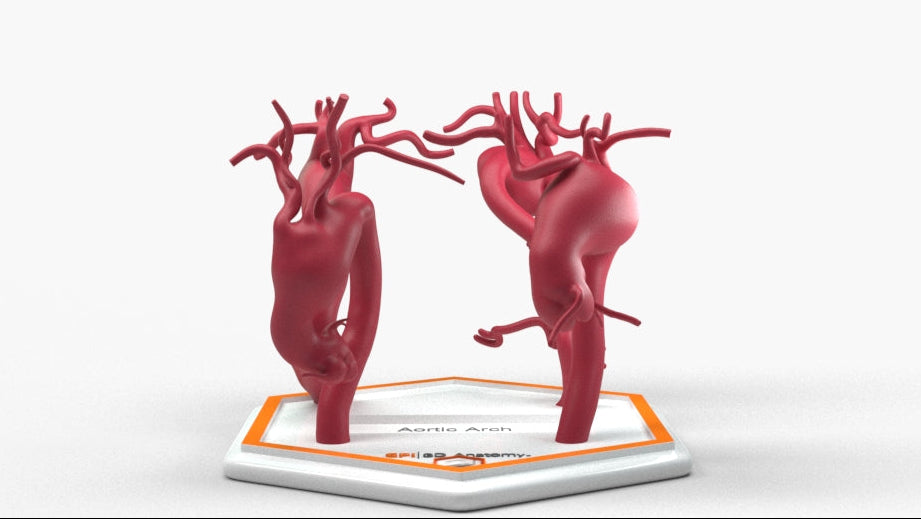 Aortic Arch Aneurysm Series – GPI 3D Anatomy