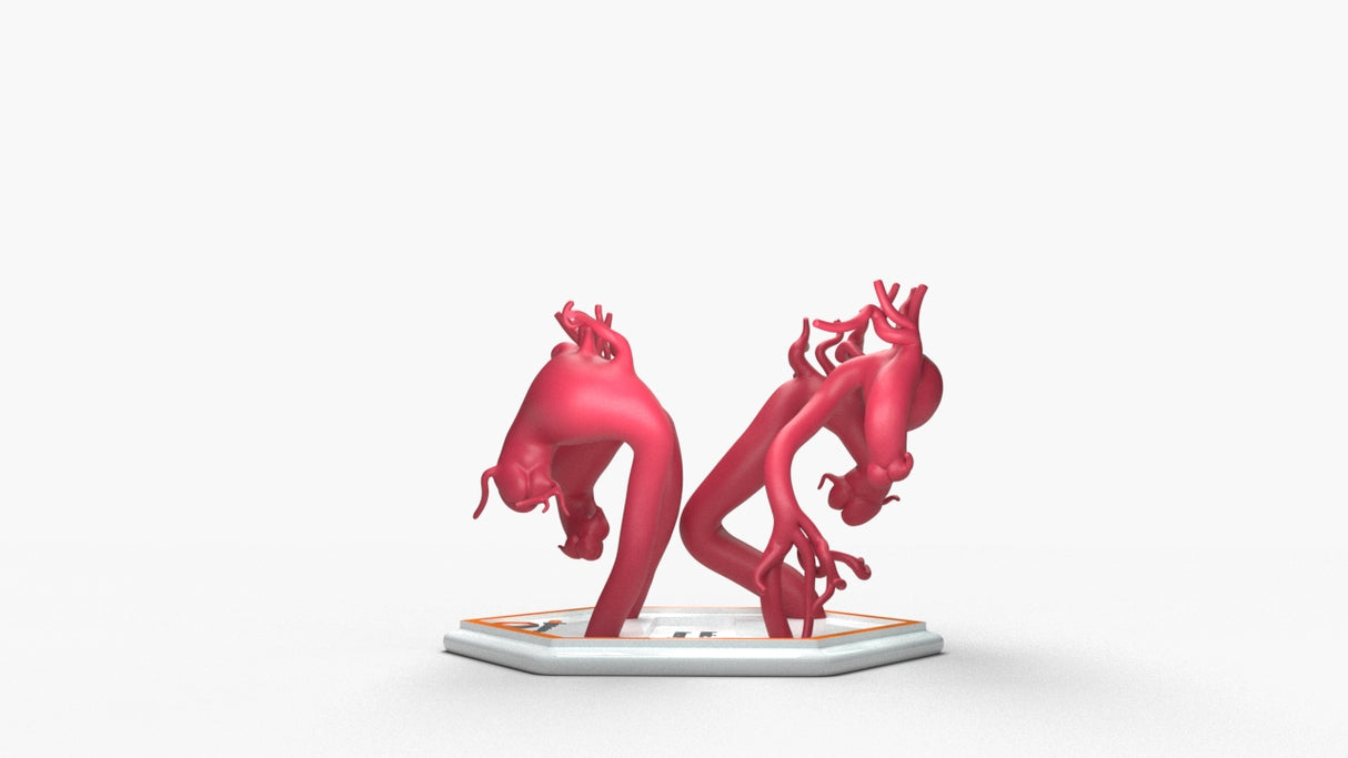 Aortic Arch Aneurysm Series