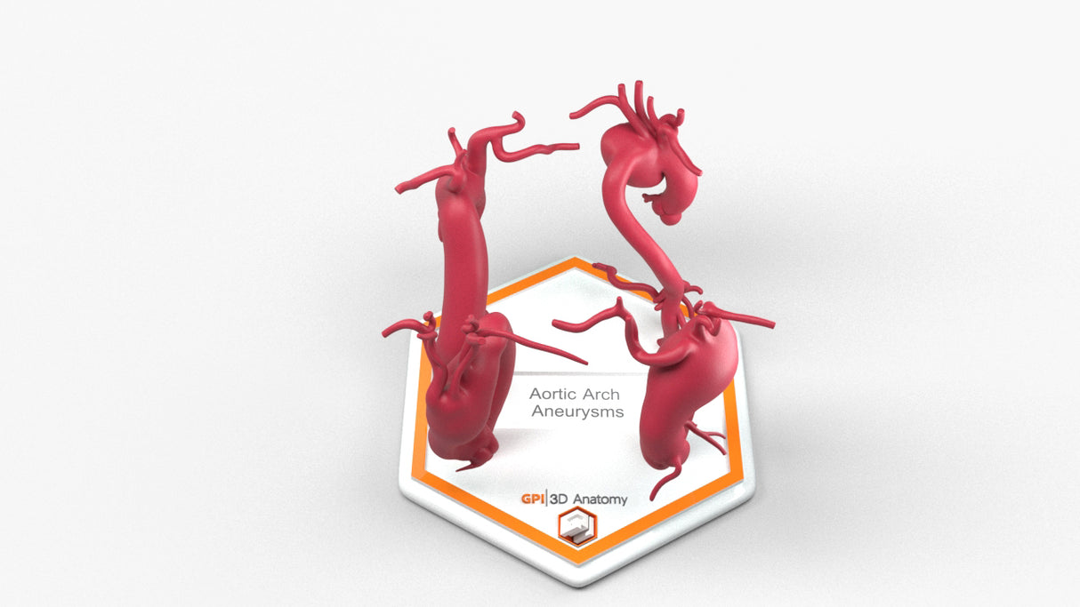 Aortic Arch Aneurysm Series