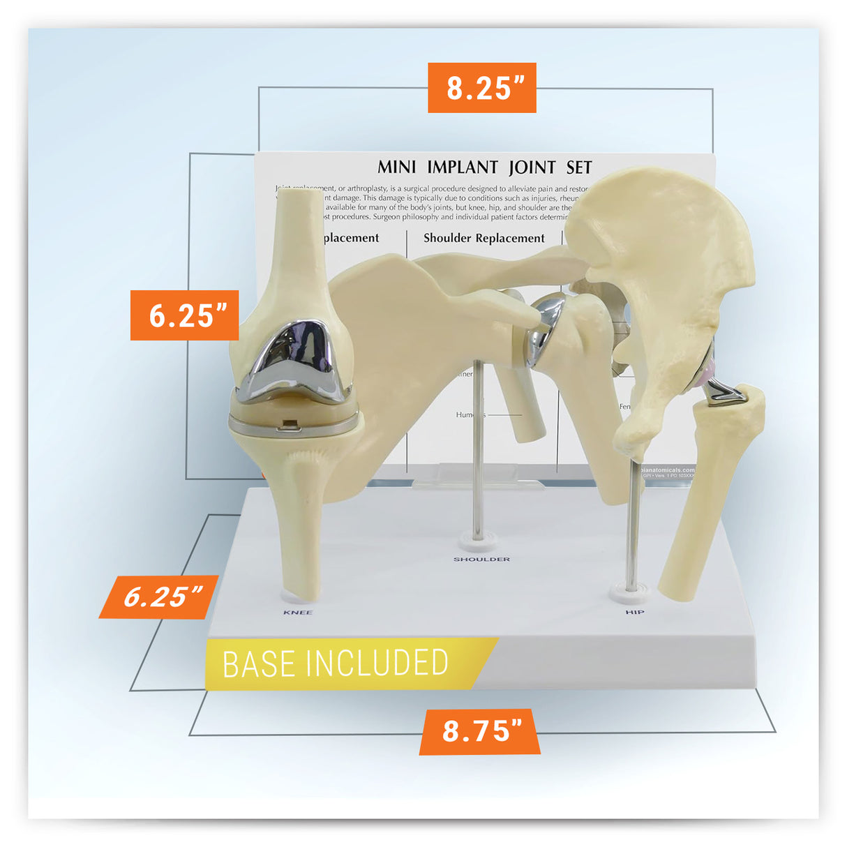 Mini Implant Joint Set