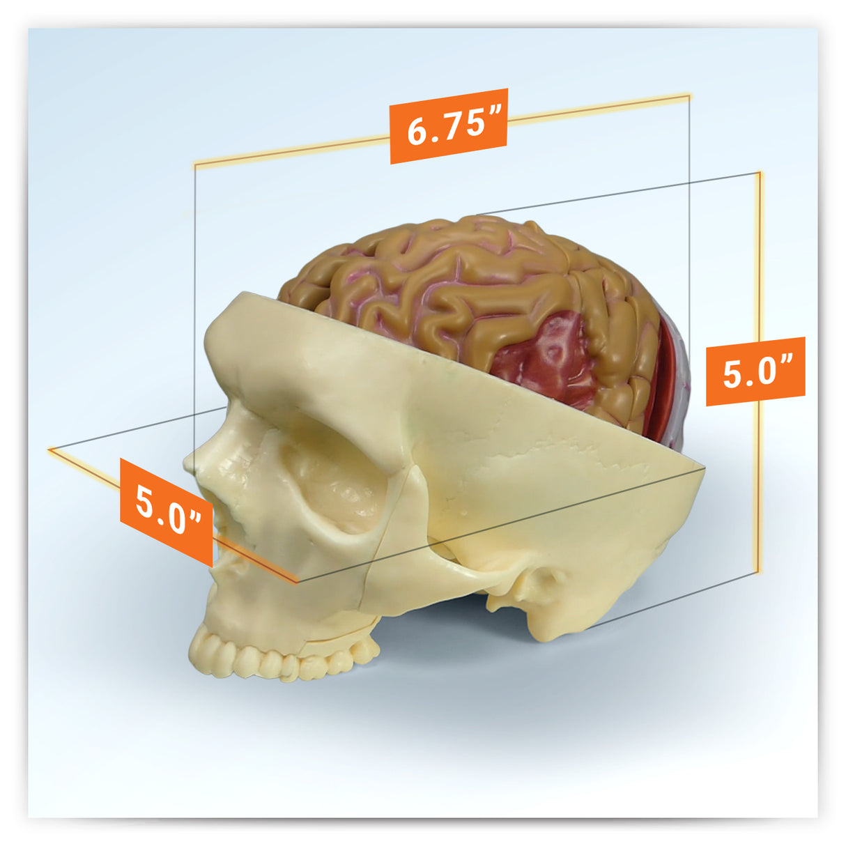 Brain with Partial Skull Model