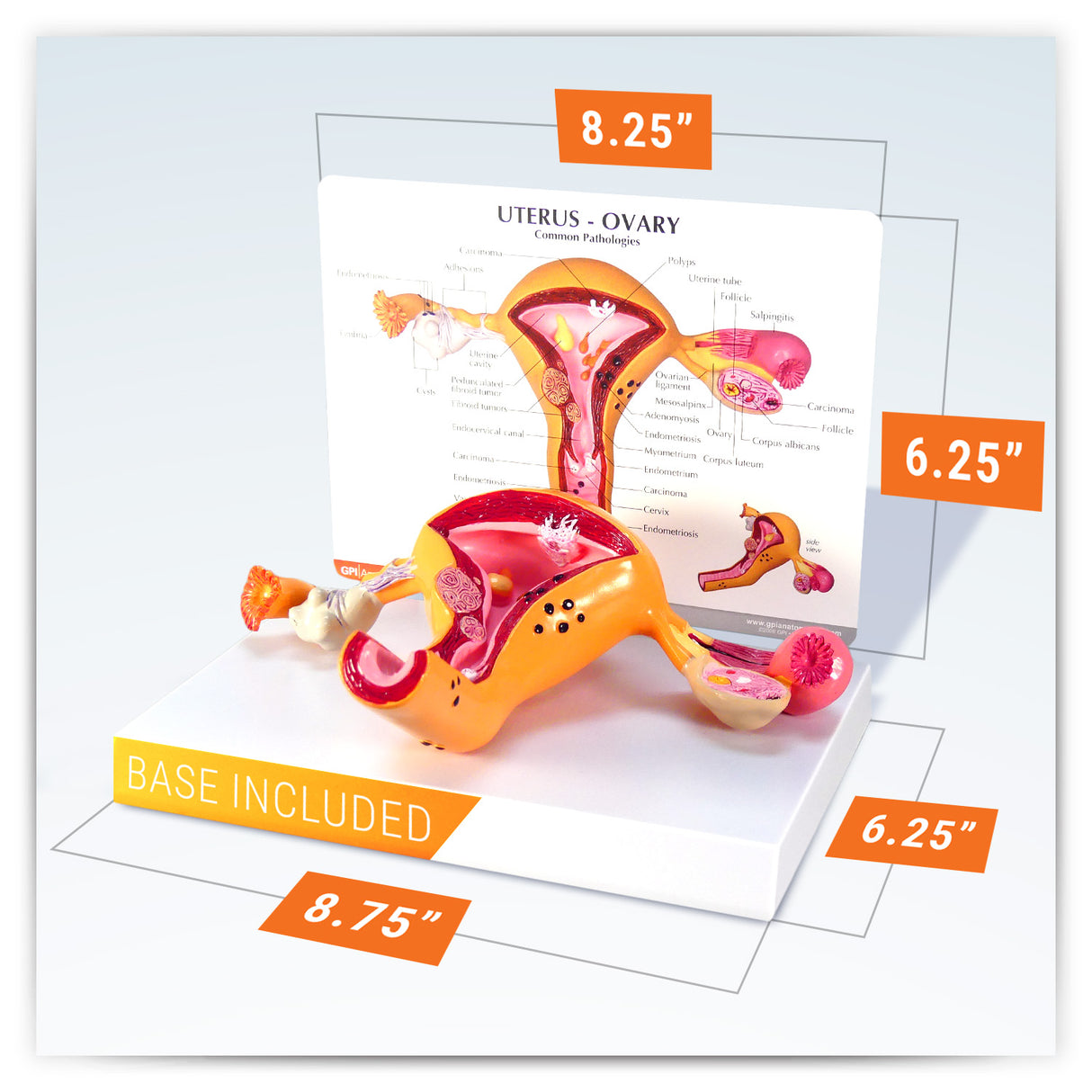 Uterus and Ovary Model