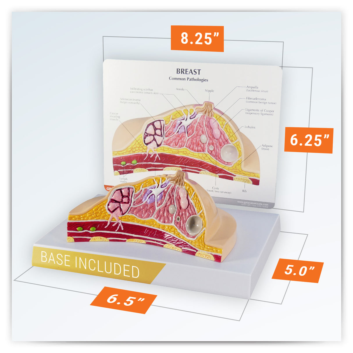 Breast Cross-Section Model