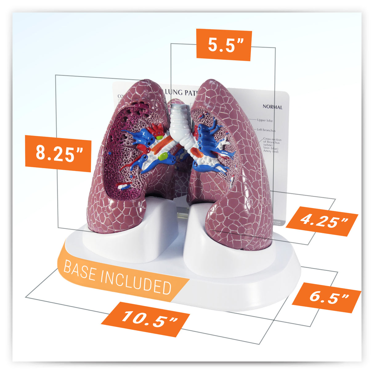 Lung Model Set with Pathologies