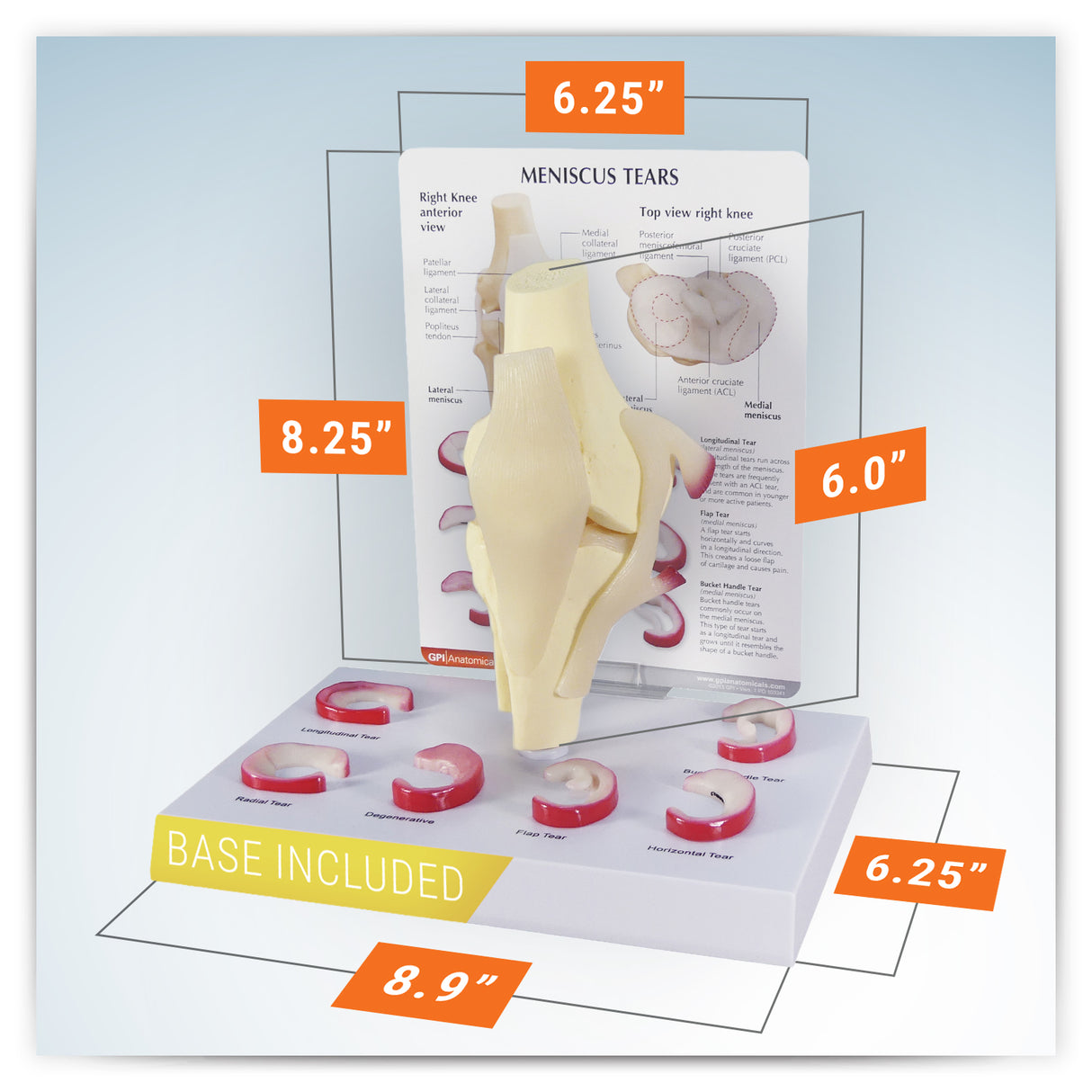Knee Model with Meniscus Tears