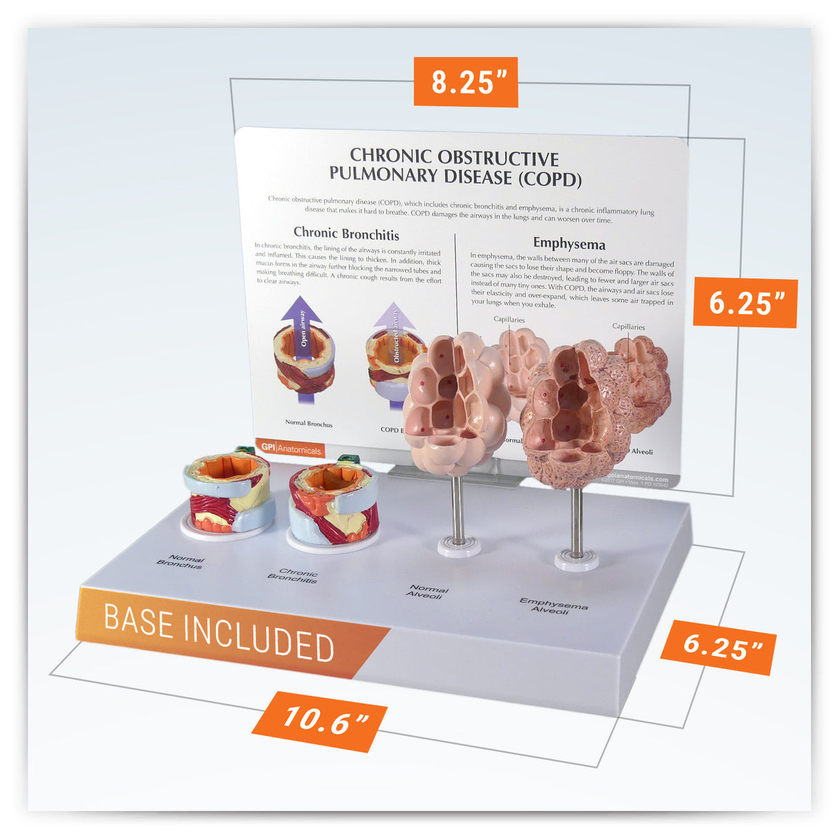 Respiratory System Model with Chronic Obstructive Pulmonary Disease (COPD)