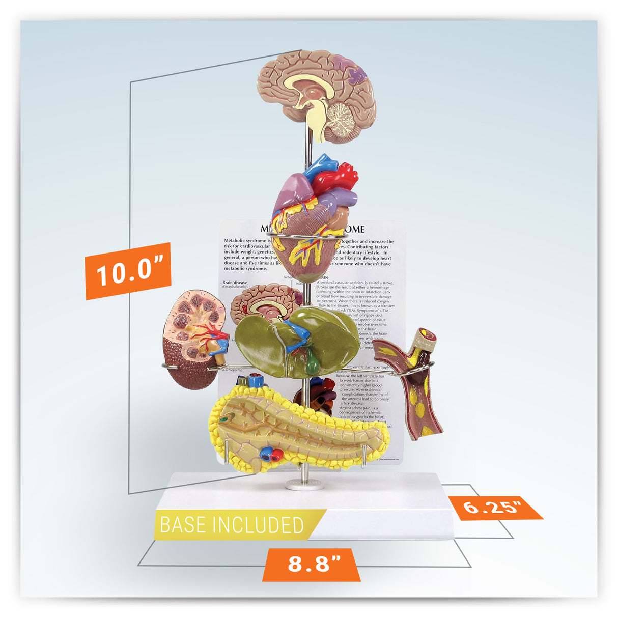 Metabolic Syndrome Model Set
