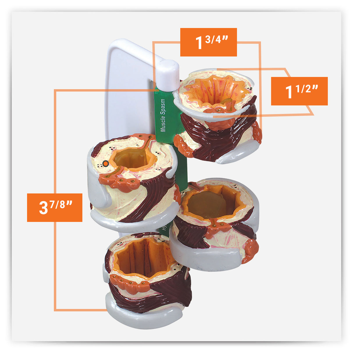 4-Piece Bronchus Model