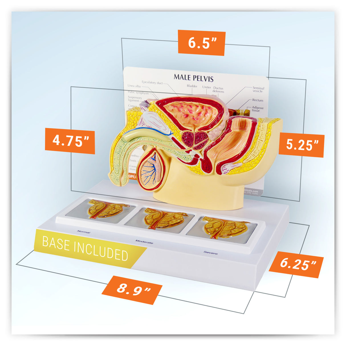 Male Pelvis Model with 3D Prostate Frame