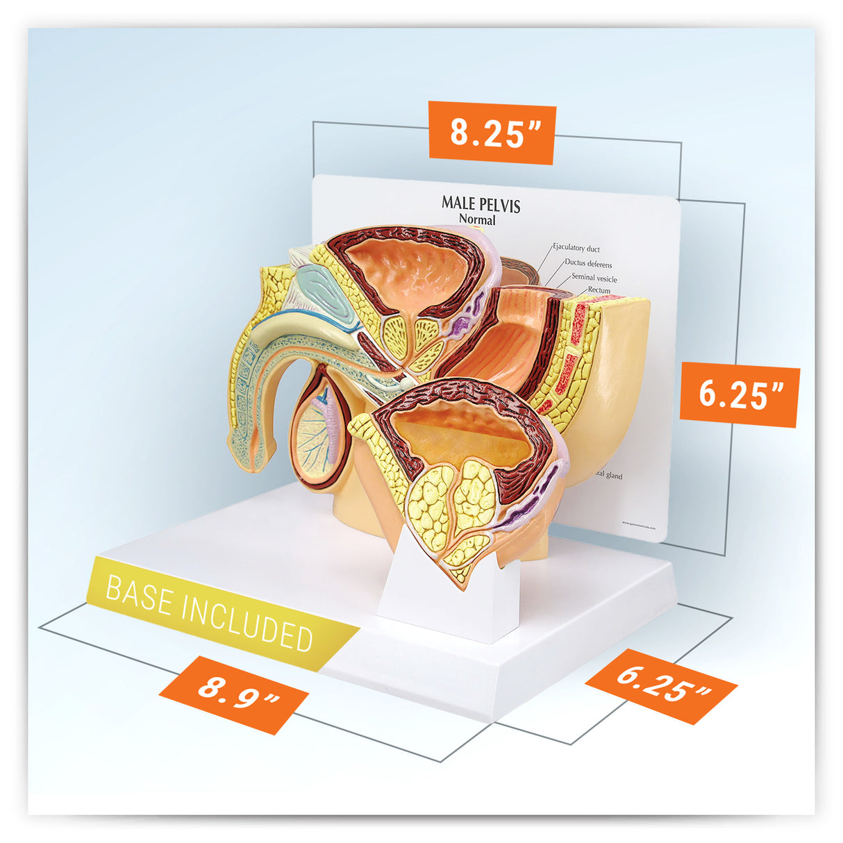 Male Pelvis Model with Benign Prostatic Hyperplasia (BPH)