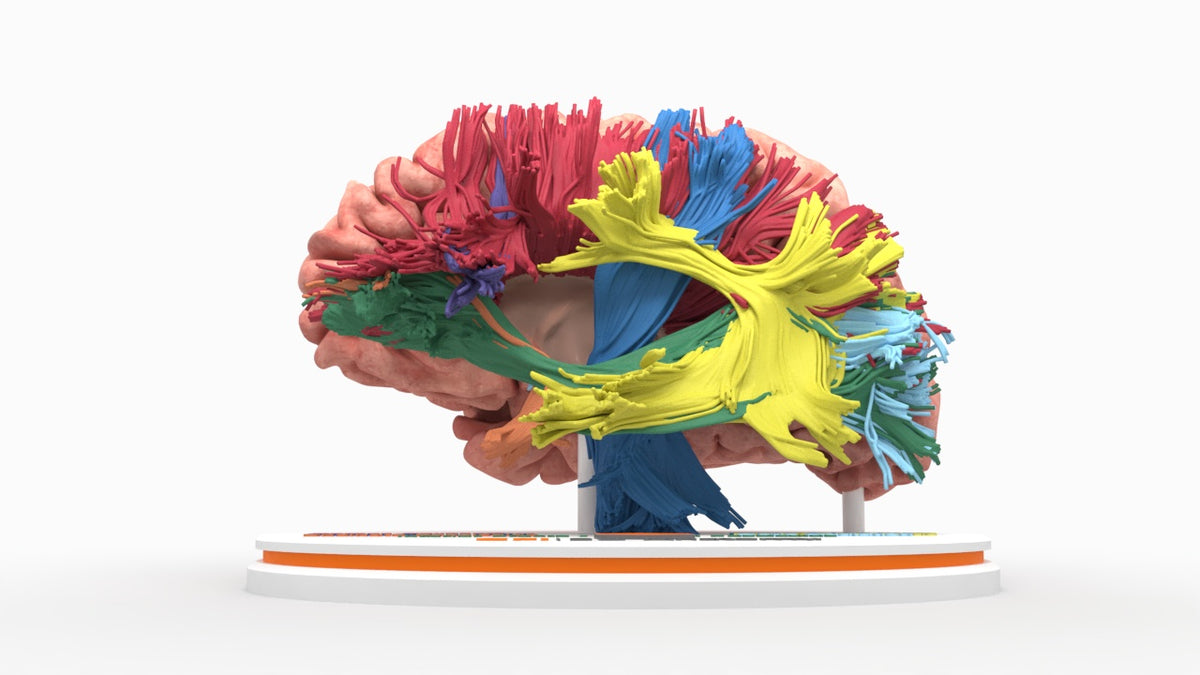Brain Tracks