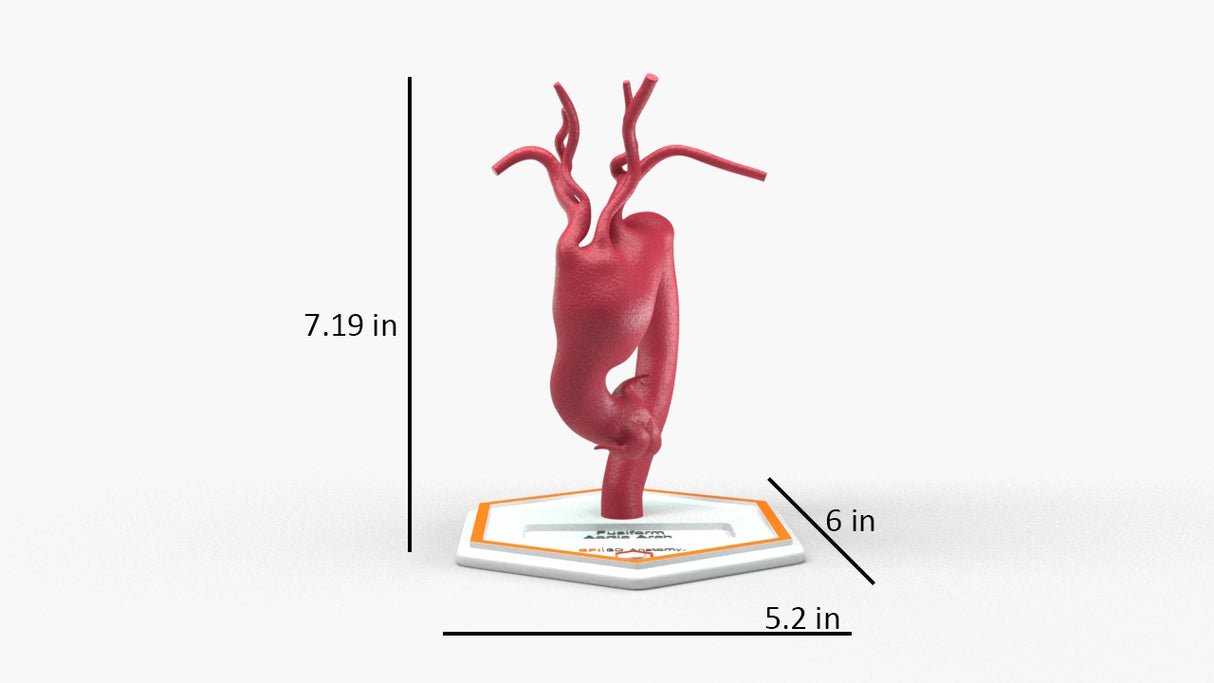 Aortic Arch - Fusiform Ascending Aneurysm