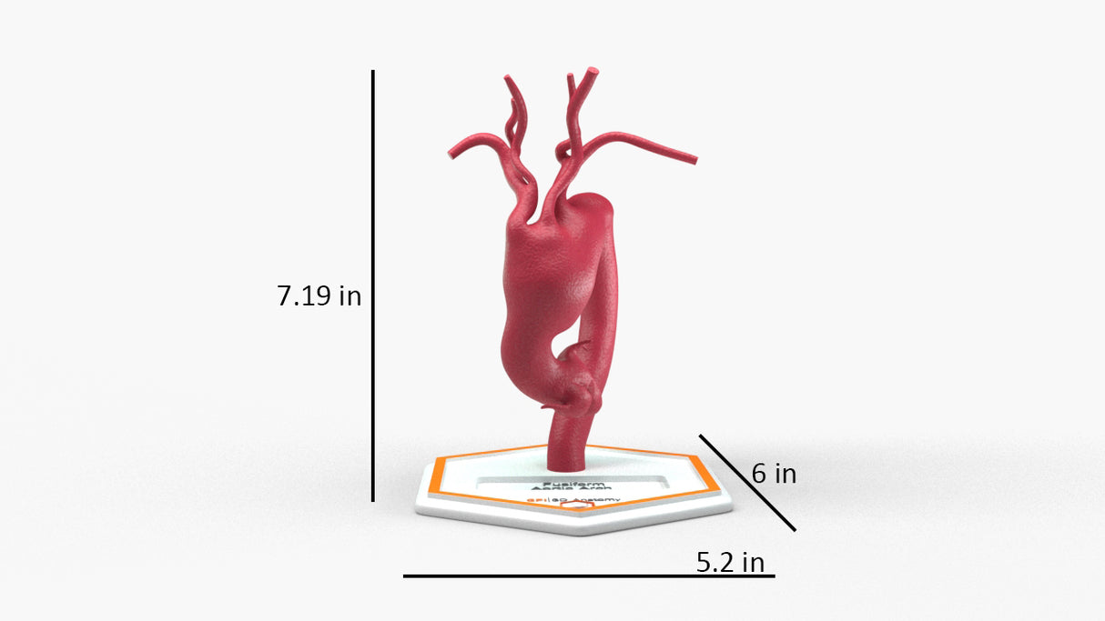Aortic Arch - Fusiform Ascending Aneurysm