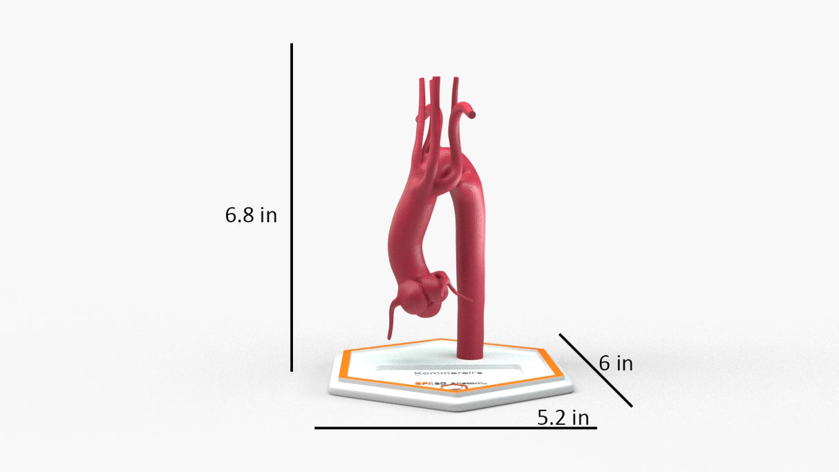 Kommerell's Diverticulum