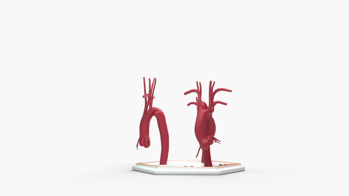 Kommerell's Diverticulum Series